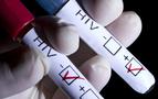 Rusya’da HIV virüsü ile enfekte insan sayısı artıyor