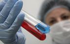 Medvedev: Her yıl AIDS hasta sayısı 10 bin artıyor