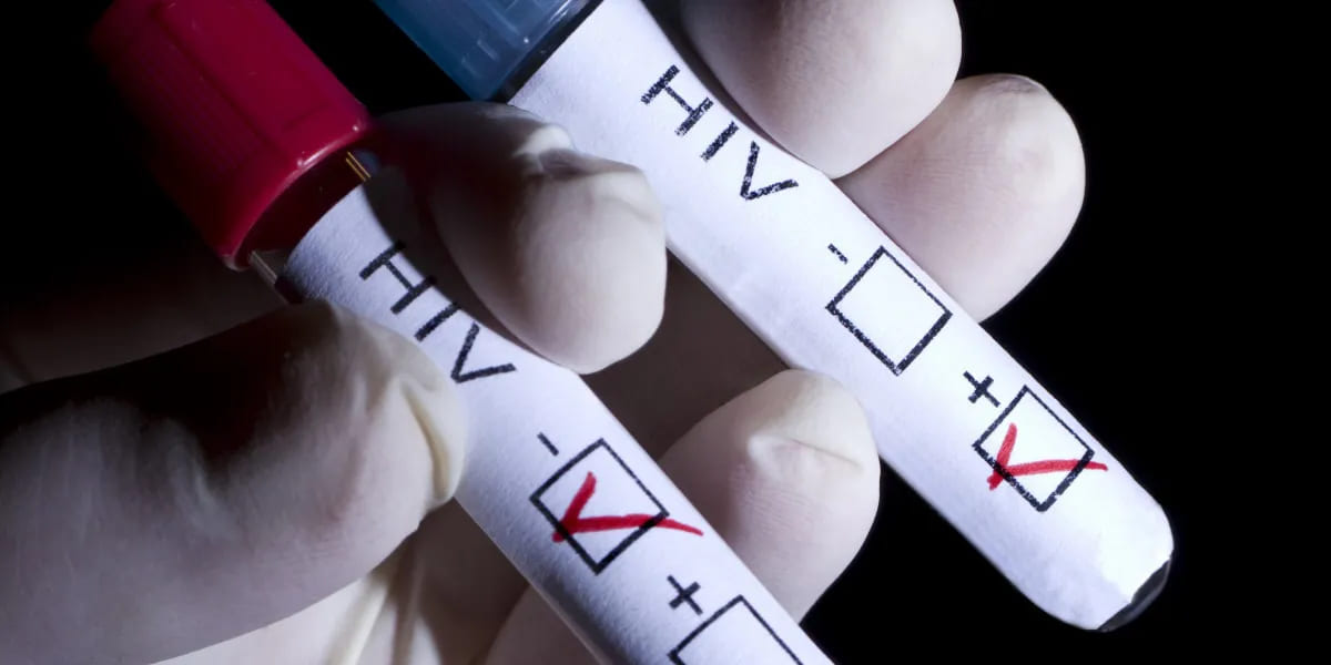 Rusya’da HIV virüsü ile enfekte insan sayısı artıyor